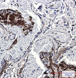 THBS1 Antibody in Immunohistochemistry (Paraffin) (IHC (P))