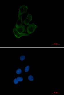 TFEB Antibody in Immunocytochemistry (ICC/IF)