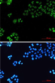 TBP Antibody in Immunocytochemistry (ICC/IF)