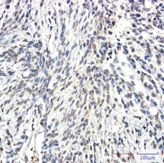 SYN2 Antibody in Immunohistochemistry (Paraffin) (IHC (P))