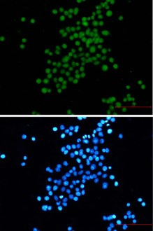 SV40gp6 Antibody in Immunocytochemistry (ICC/IF)