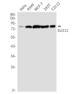SUZ12 Antibody in Western Blot (WB)