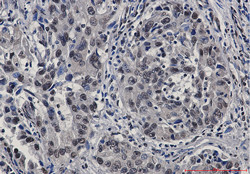 STAT4 Antibody in Immunohistochemistry (Paraffin) (IHC (P))