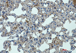 Stat2 Antibody in Immunohistochemistry (Paraffin) (IHC (P))