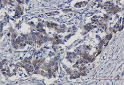 SORT1 Antibody in Immunohistochemistry (Paraffin) (IHC (P))