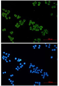 SNAP25 Antibody in Immunocytochemistry (ICC/IF)