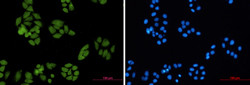 SMAD4 Antibody in Immunocytochemistry (ICC/IF)