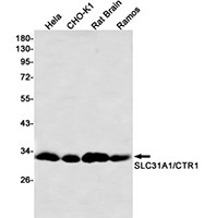 SLC31A1 Antibody in Western Blot (WB)
