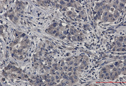 UBE2D1 Antibody in Immunohistochemistry (Paraffin) (IHC (P))