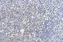 SEMA7A Antibody in Immunohistochemistry (Paraffin) (IHC (P))