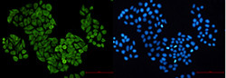 S100A6 Antibody in Immunocytochemistry (ICC/IF)