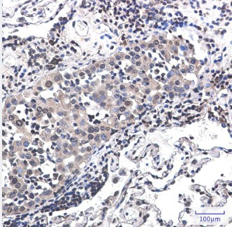 RPS6KA3 Antibody in Immunohistochemistry (Paraffin) (IHC (P))