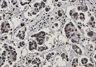 RAD50 Antibody in Immunohistochemistry (Paraffin) (IHC (P))