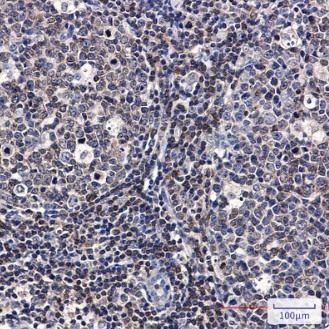 PTK2B Antibody in Immunohistochemistry (Paraffin) (IHC (P))