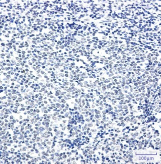 DLG2 Antibody in Immunohistochemistry (Paraffin) (IHC (P))