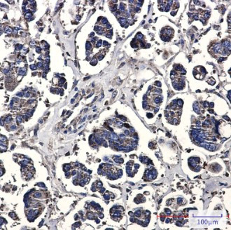 PHB1 Antibody in Immunohistochemistry (Paraffin) (IHC (P))