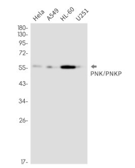 PNKP Antibody in Western Blot (WB)