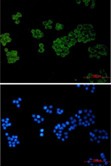 PLCG1 Antibody in Immunocytochemistry (ICC/IF)