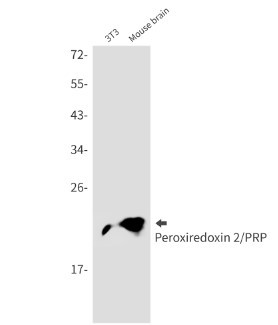 PRDX2 Antibody in Western Blot (WB)