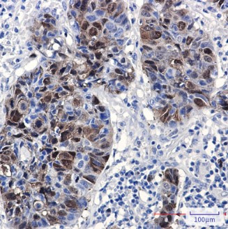 PBK Antibody in Immunohistochemistry (Paraffin) (IHC (P))