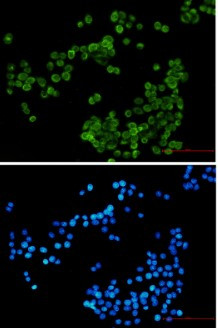 NCF4 Antibody in Immunocytochemistry (ICC/IF)