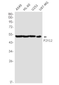 P2RY12 Antibody in Western Blot (WB)