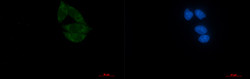 NUP155 Antibody in Immunocytochemistry (ICC/IF)