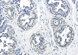 NDUFS2 Antibody in Immunohistochemistry (Paraffin) (IHC (P))