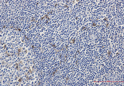 MERTK Antibody in Immunohistochemistry (Paraffin) (IHC (P))
