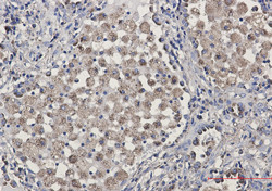 LAMP2 Antibody in Immunohistochemistry (Paraffin) (IHC (P))