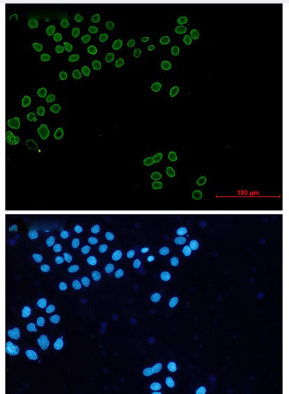 LMNA Antibody in Immunocytochemistry (ICC/IF)