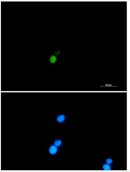 XRCC6 Antibody in Immunocytochemistry (ICC/IF)