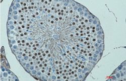 DOT1L Antibody in Immunohistochemistry (Paraffin) (IHC (P))