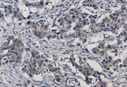 IRF3 Antibody in Immunohistochemistry (Paraffin) (IHC (P))