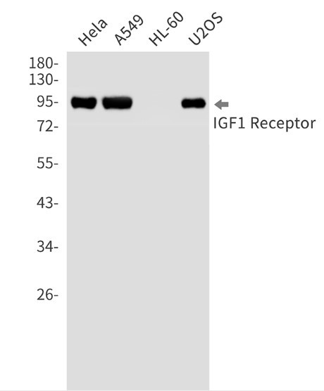 IGF1R Antibody in Western Blot (WB)