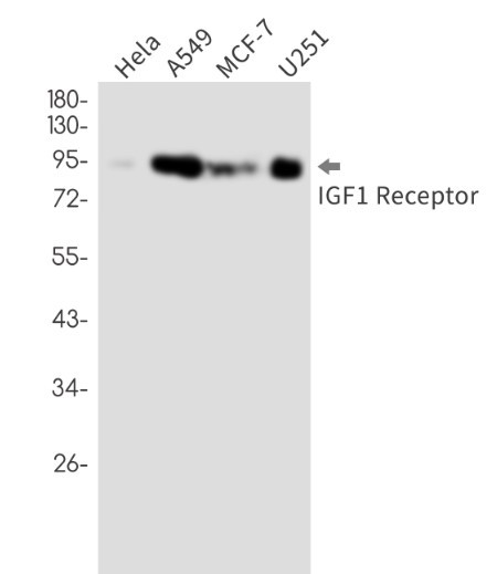 IGF1R Antibody in Western Blot (WB)
