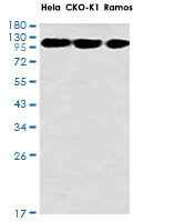 HKDC1 Antibody in Western Blot (WB)