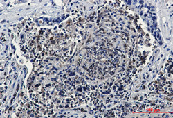 HJURP Antibody in Immunohistochemistry (Paraffin) (IHC (P))