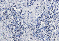 H2AX Antibody in Immunohistochemistry (Paraffin) (IHC (P))