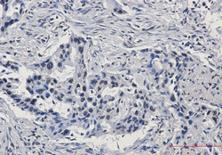 ARNT Antibody in Immunohistochemistry (Paraffin) (IHC (P))