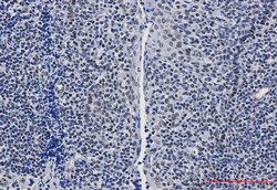 GTPBP4 Antibody in Immunohistochemistry (Paraffin) (IHC (P))