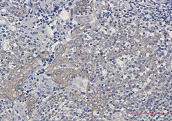 G6PD Antibody in Immunohistochemistry (Paraffin) (IHC (P))