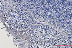 GCLM Antibody in Immunohistochemistry (Paraffin) (IHC (P))
