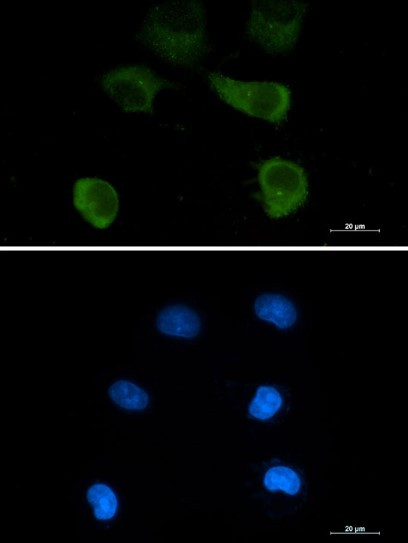 TUBG1 Antibody in Immunocytochemistry (ICC/IF)