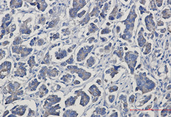 JUP Antibody in Immunohistochemistry (Paraffin) (IHC (P))
