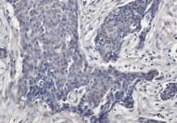 FHL1 Antibody in Immunohistochemistry (Paraffin) (IHC (P))