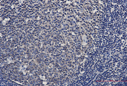 EZR Antibody in Immunohistochemistry (Paraffin) (IHC (P))