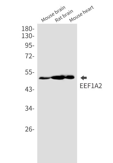 EEF1A2 Antibody in Western Blot (WB)