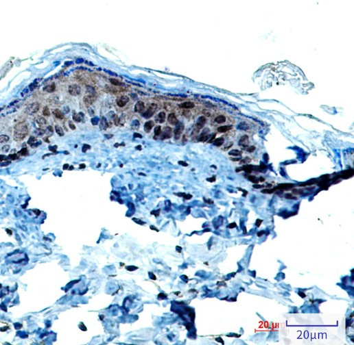 KRT9 Antibody in Immunohistochemistry (Paraffin) (IHC (P))