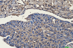 CFL1 Antibody in Immunohistochemistry (Paraffin) (IHC (P))